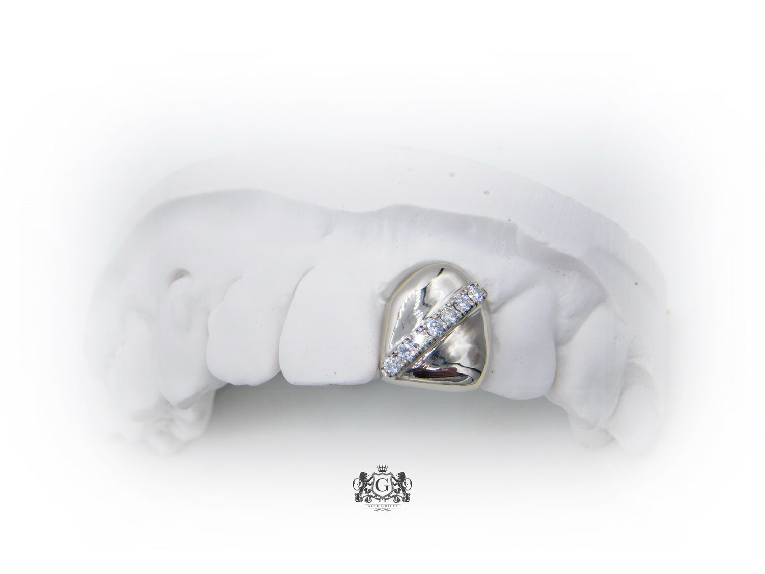 Gold tooth with diamonds strip