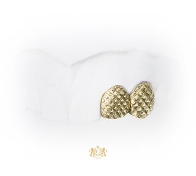 Two Pineapple Gold Teeth