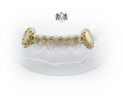 Chain Reaction Grillz