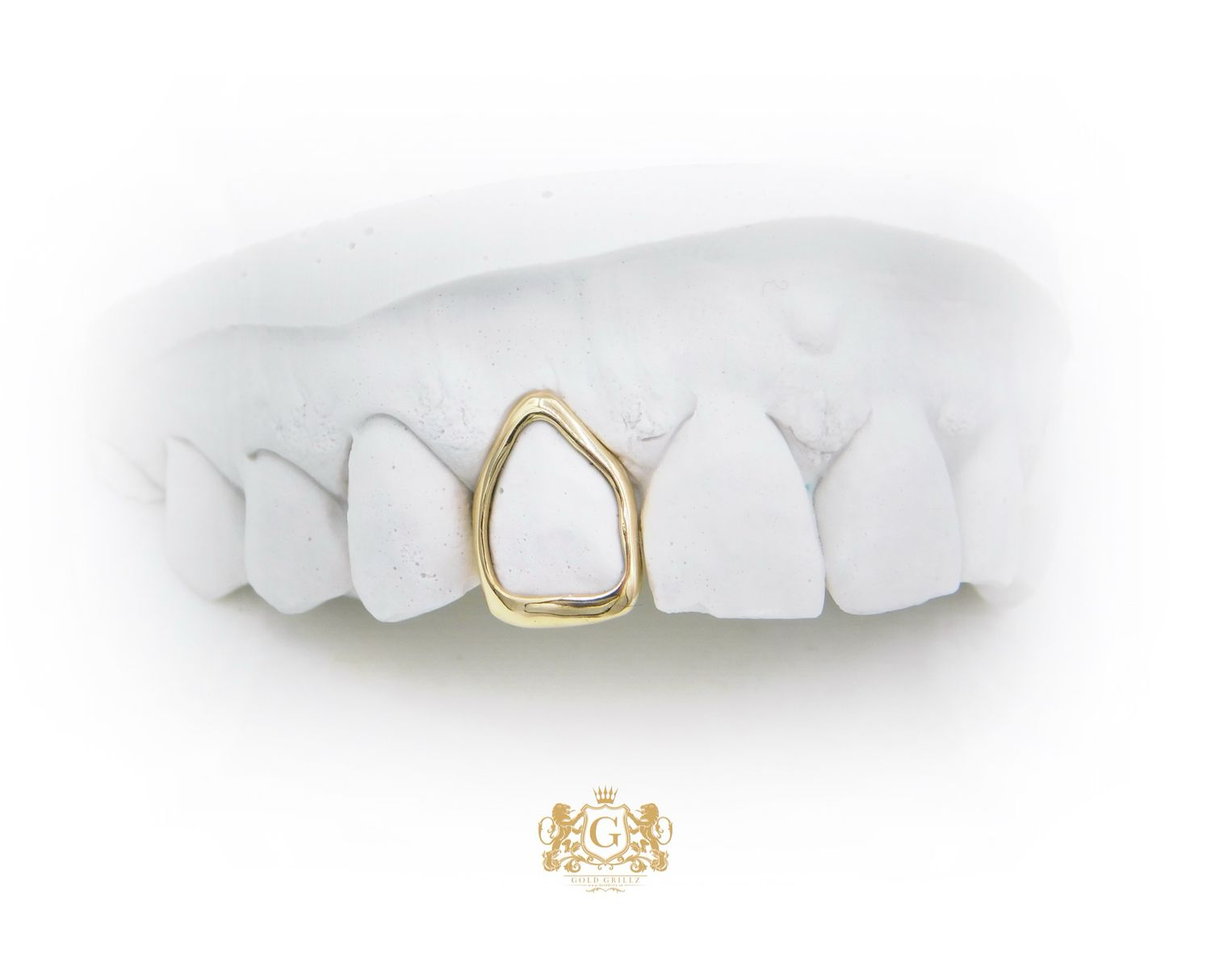 Gold tooth - Window design