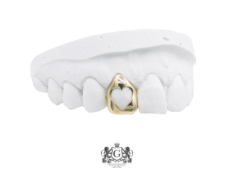 Gold teeth - Heart Design