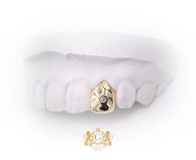 One gold tooth with one diamond
