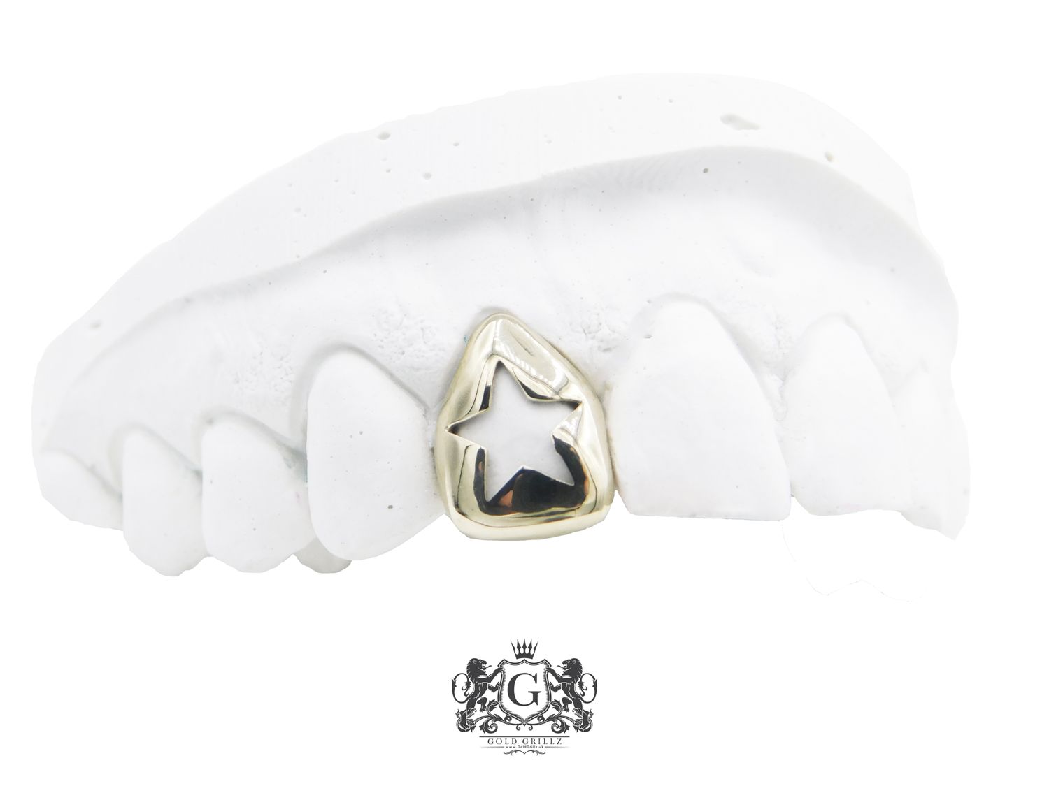 Gold teeth - Star Design