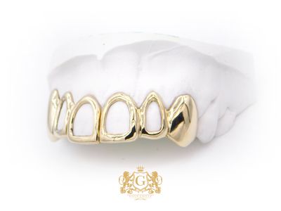 Gold Grillz - 4 front windows
