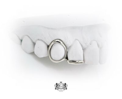 Window design &amp; Gold strip