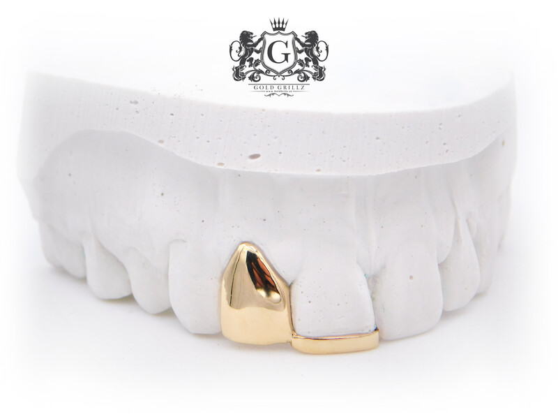 Gold Tooth &amp; Gold strip