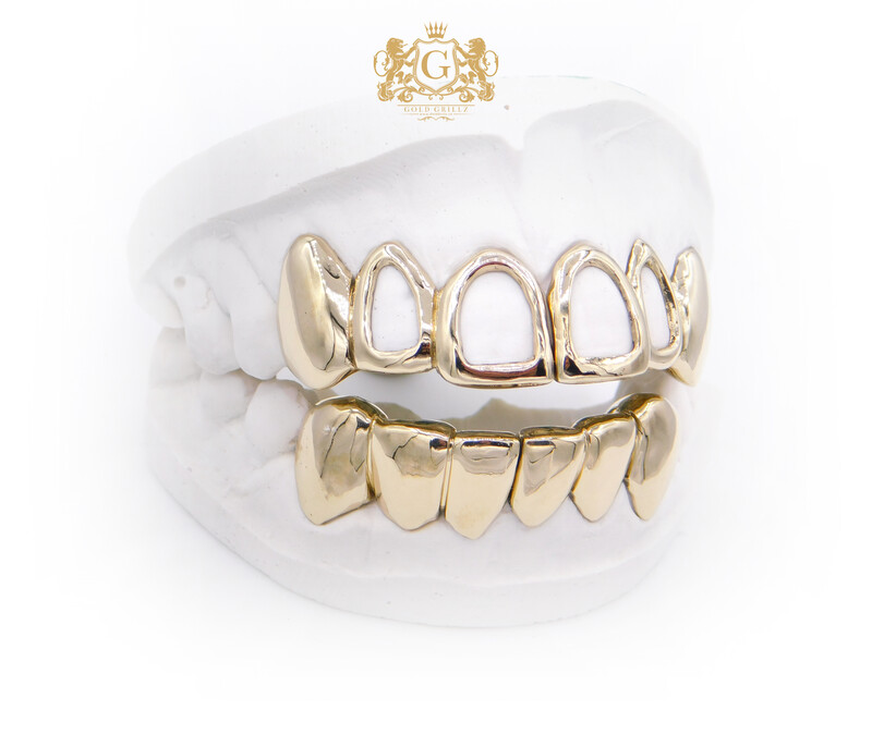 Upper Windows &amp; Lower Plain gold grillz