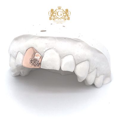 Rose Gold Tooth