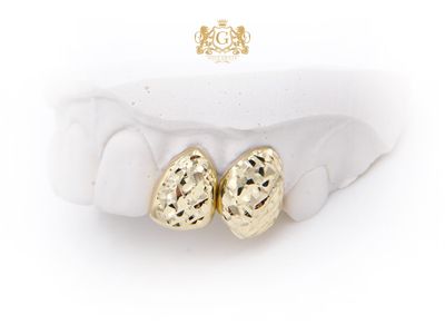 Two Diamond Cut Gold Teeth