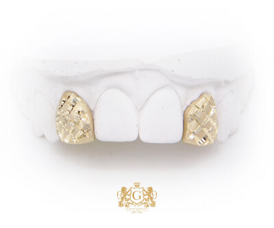 Two Diamond Dust Gold Teeth