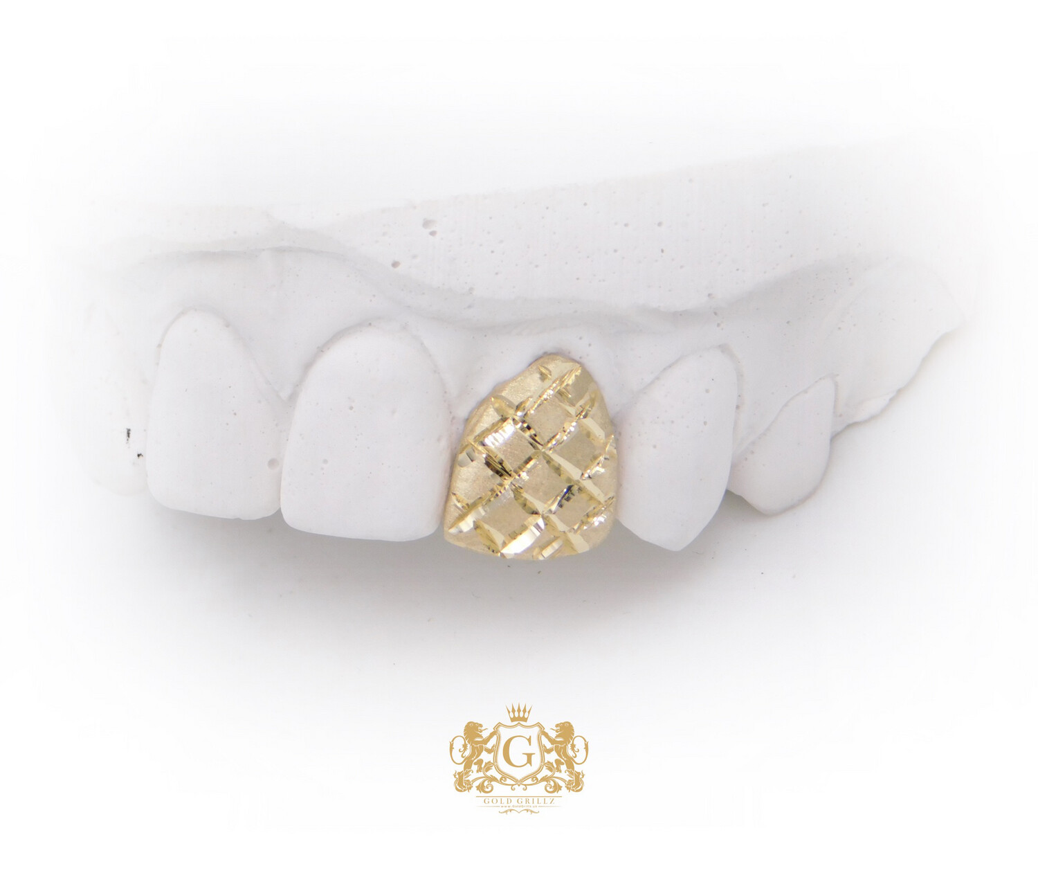 Diamond Dust Gold Tooth
