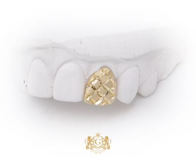 Diamond Dust Gold Tooth