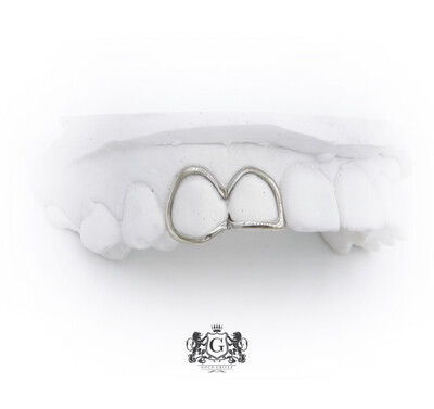2Frame Gold teeth