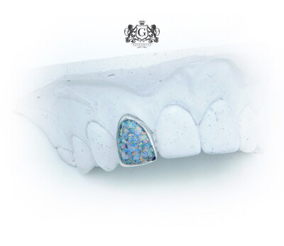 Opal Gold Tooth