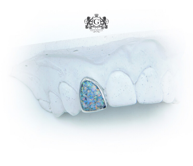 Opal Gold Tooth
