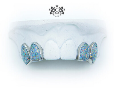 4 Opal Teeth