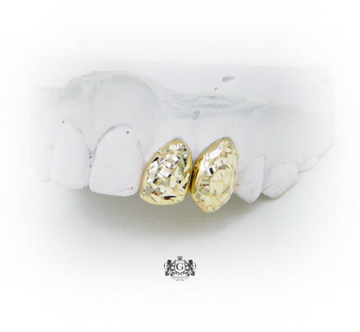Two Rose Cut Gold Teeth