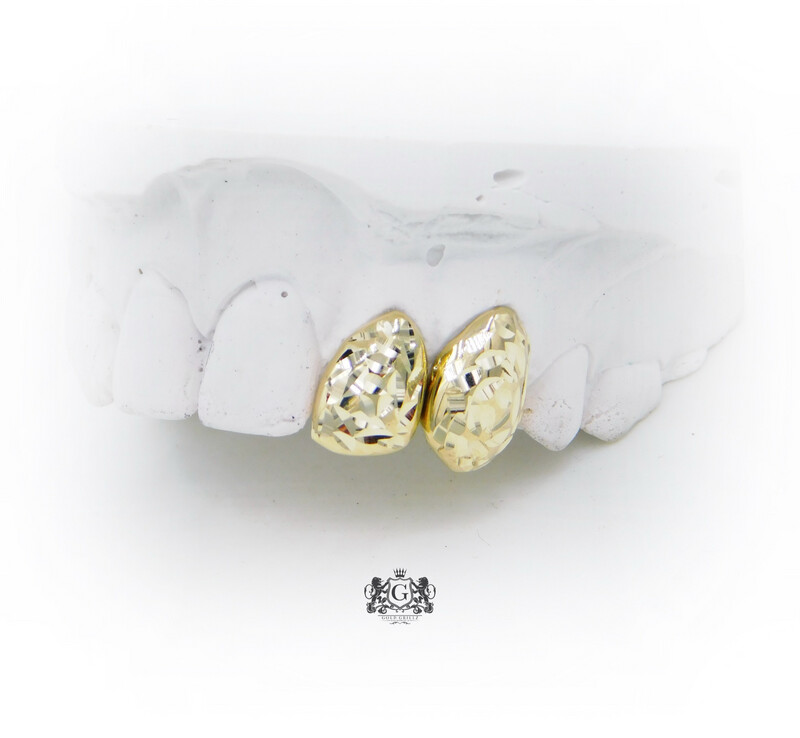 Two Rose Cut Gold Teeth