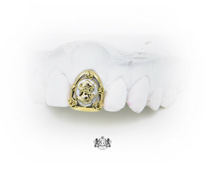Cameo Gold Tooth