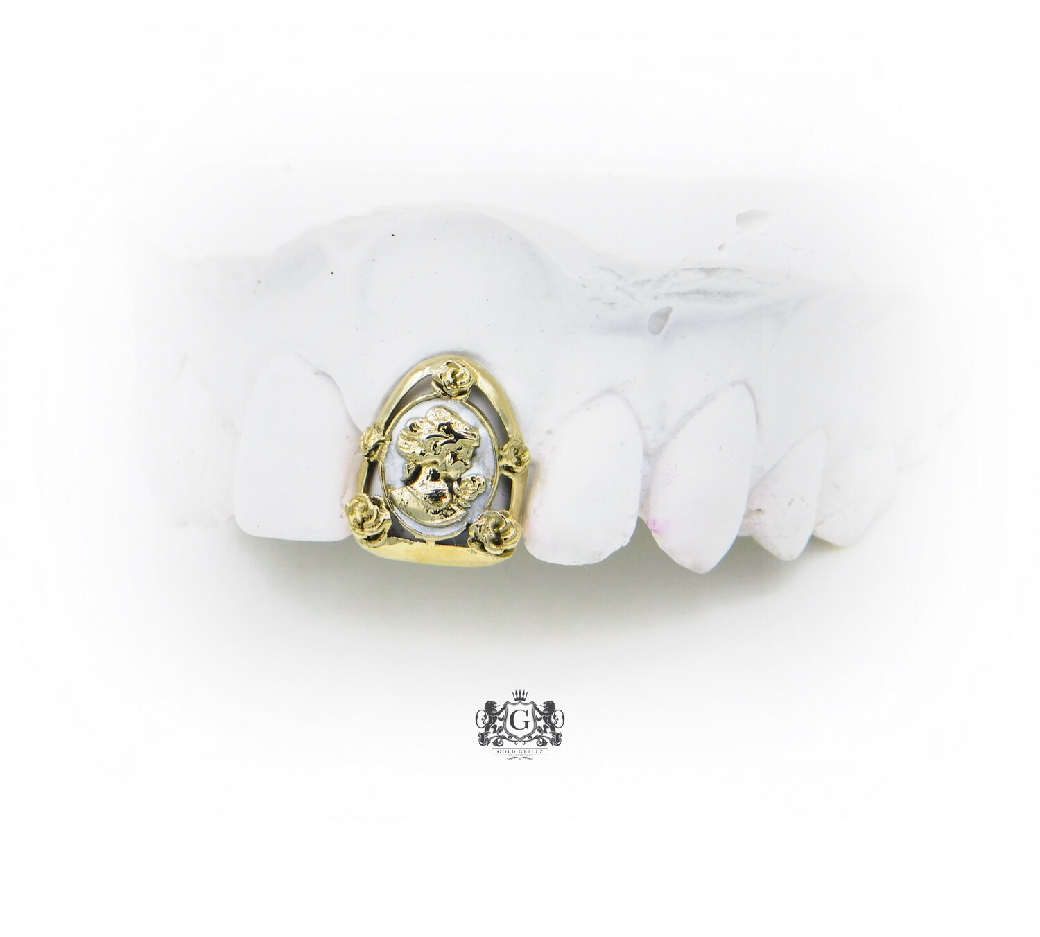 Cameo Gold Tooth