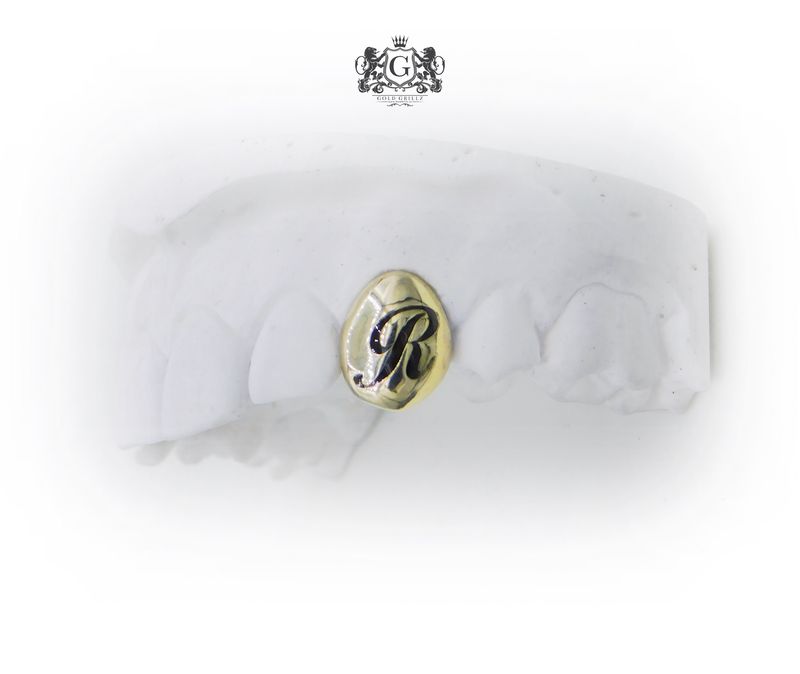 Gold Tooth with Enamel Letter