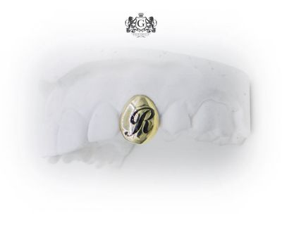 Gold Tooth with Enamel Letter