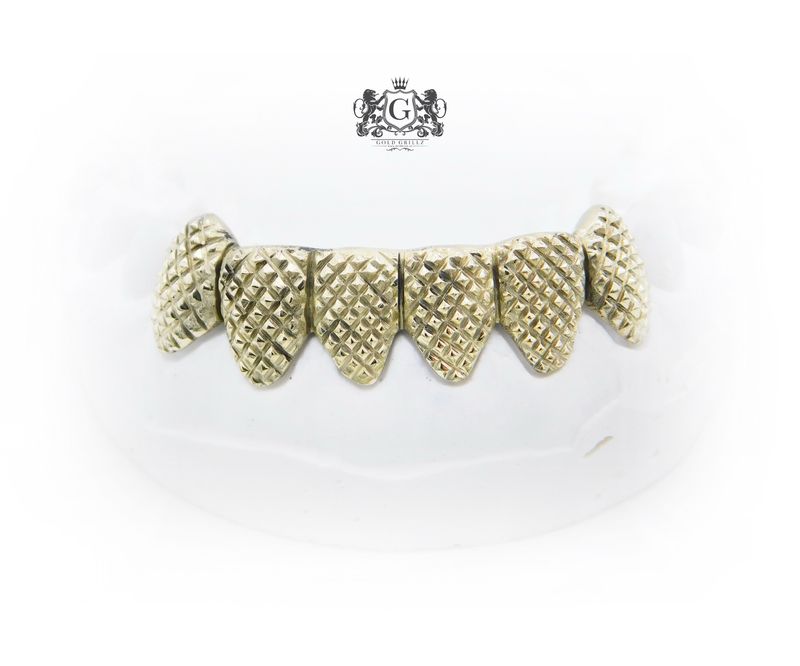 Pineapple Cut Gold Grillz