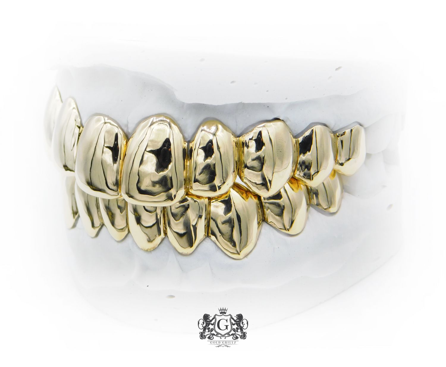 Upper &amp; Lower gold grillz
