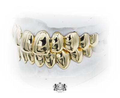 Upper &amp; Lower gold grillz
