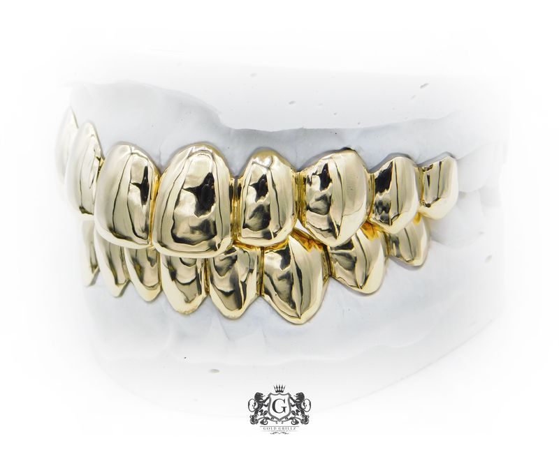 Upper &amp; Lower gold grillz