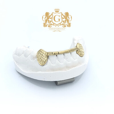 Pineapple Canine &amp; Straight Bar Grillz