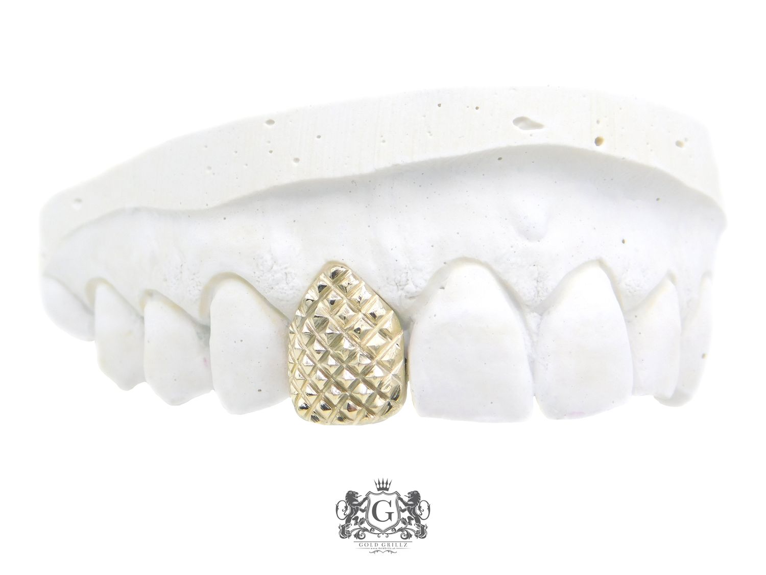 Gold tooth - Pineapple design