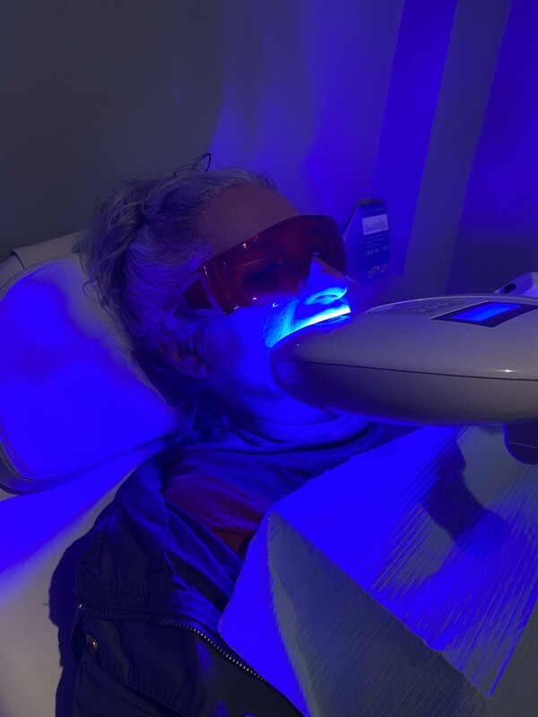BleachBright Whitening