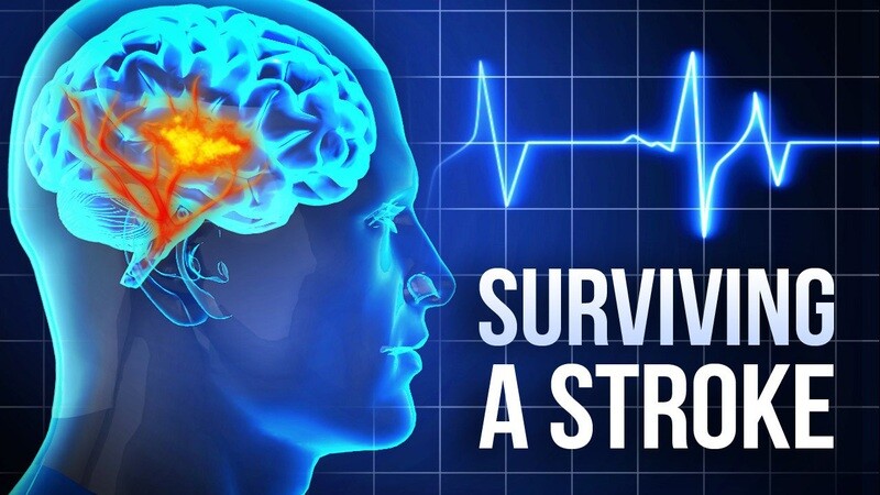 Natural remedy for Stroke