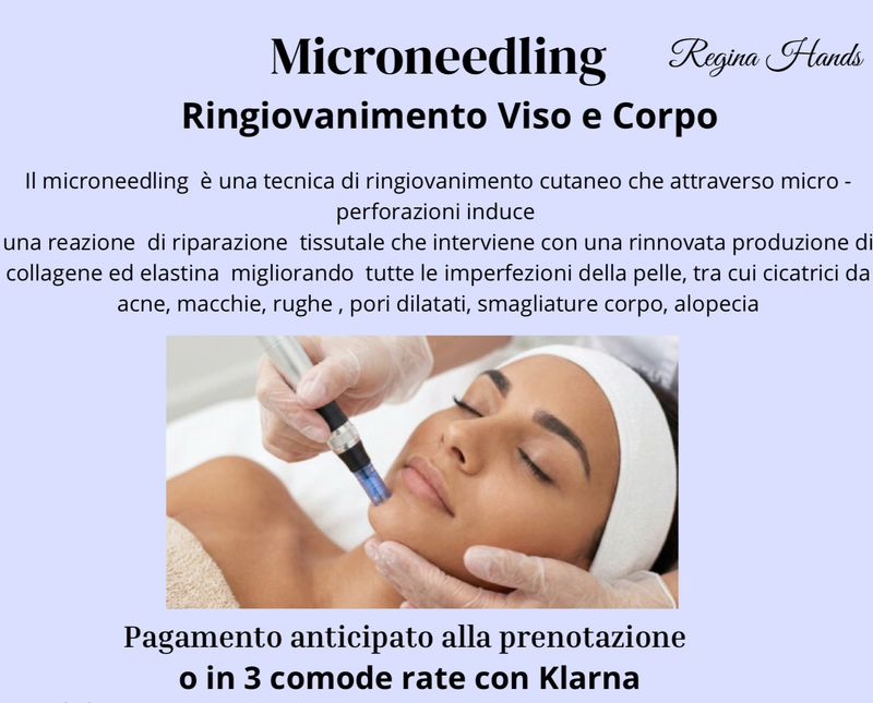 Microneedling - 1 Trattamento Ringiovanimento Viso/Corpo Microneedling - 1 Trattamento Ringiovanimento Viso/Corpo