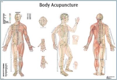 Akupunkturplanscher