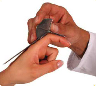 Vinkelmätare Goniometer för fingrar 15 cm i rostfritt stål