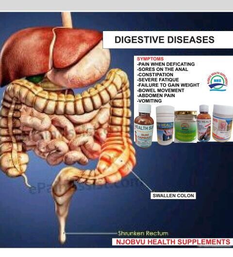 Digestion system