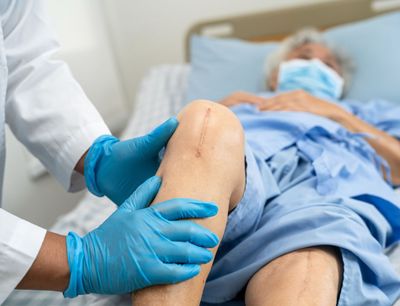 Knee Surgery Recommendations