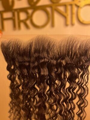 20' Frontal