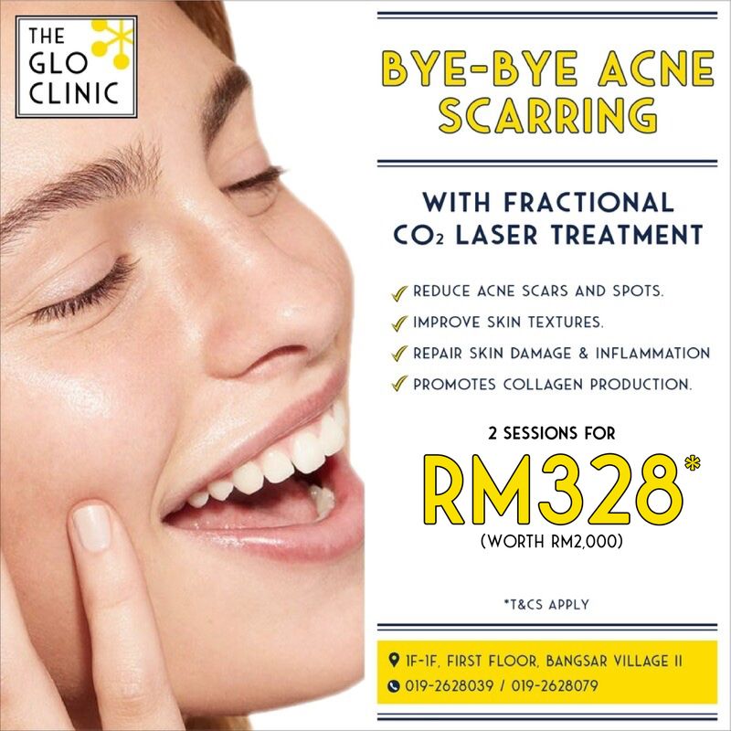 [ONLINE EXCLUSIVE] ANNIVERSARY FRACTIONAL CO2 LASER PROMO