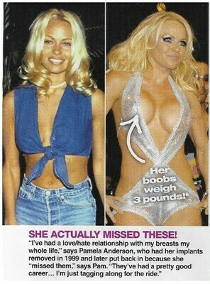 Anderson, Pamela / She Actually Missed These! | March 2010