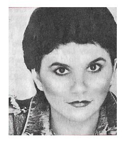 Ronstadt, Linda / Closeup-Short Hair-Mad Love Era #4 / 1980
