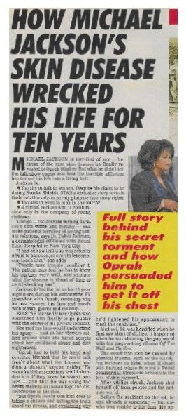 Jackson, Michael / How Skin Disease Wrecked His Life for Years (1993)