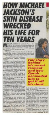 Jackson, Michael / How Skin Disease Wrecked His Life for Years (1993)