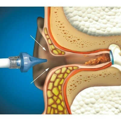 Ear Canal Self-Clean &amp; Maintenance Packs (10 Pack)