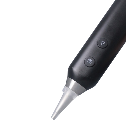OTOvideo TM Otoscope, Colour: Black