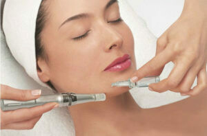Microneedling facial + principios activos