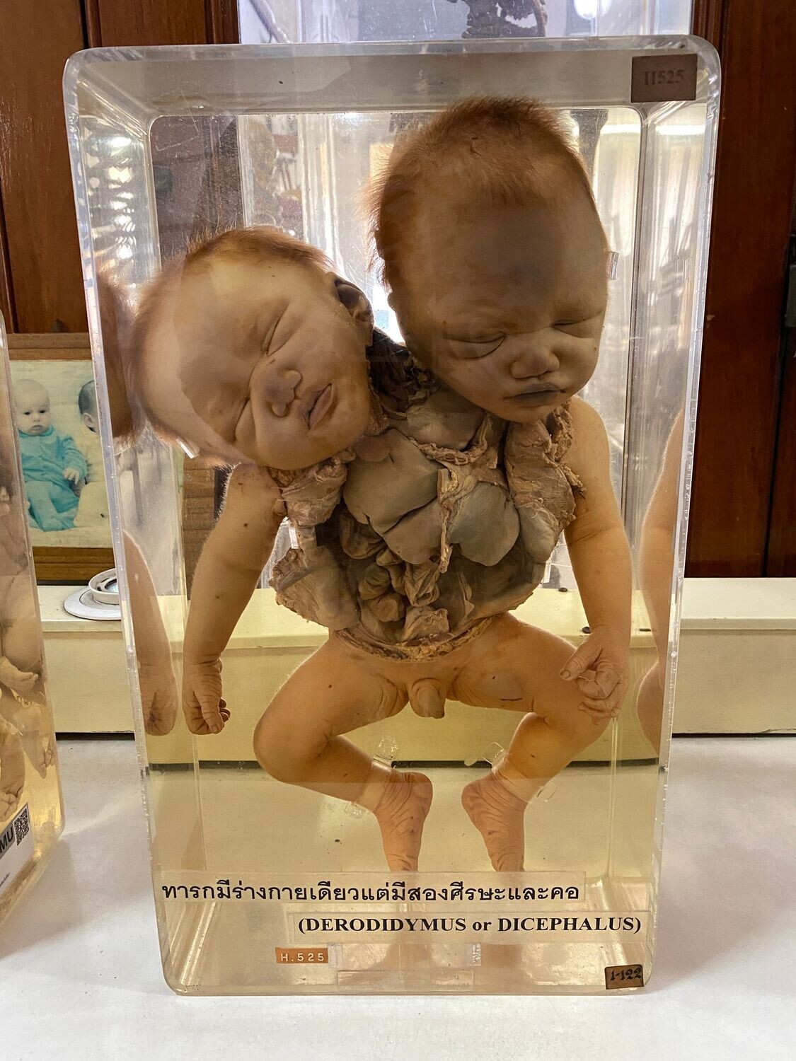 Staring at Death – The Medical Atrocities (collector's edition)