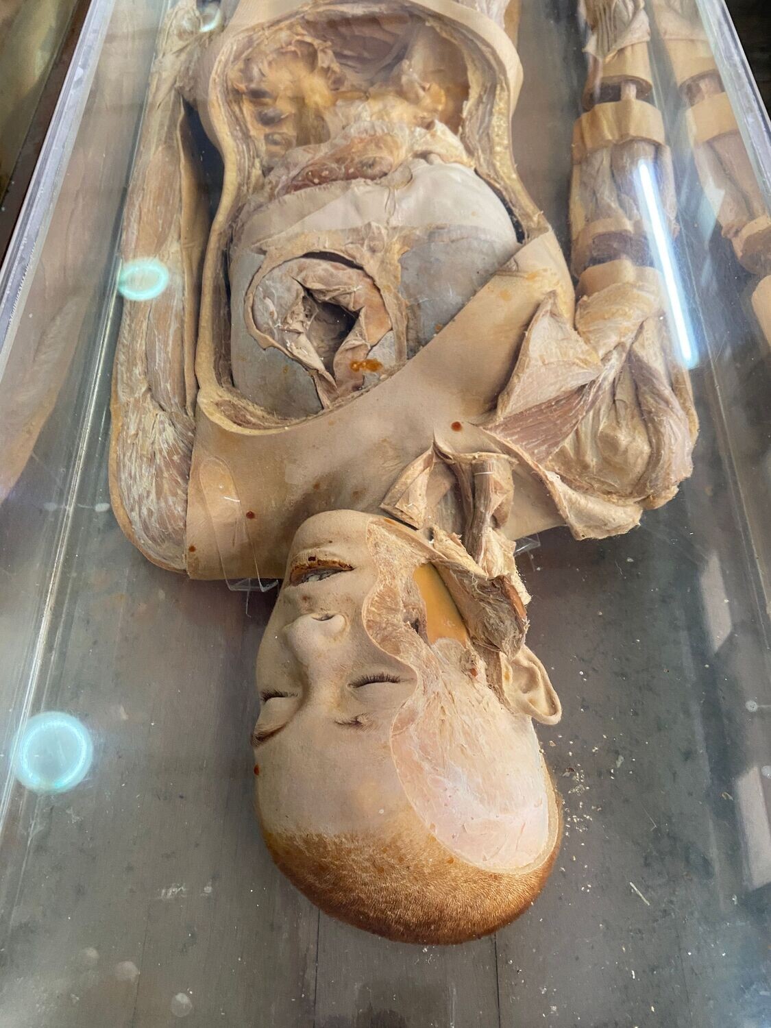 Staring at Death – The Medical Atrocities (collector's edition)